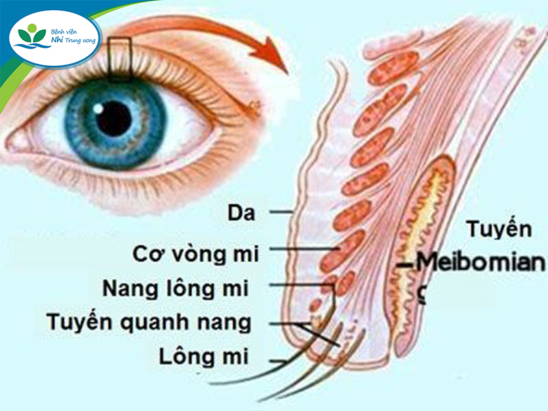 Bệnh chắp – lẹo mắt